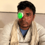 Sponsor Eye Surgery for a Needy Man